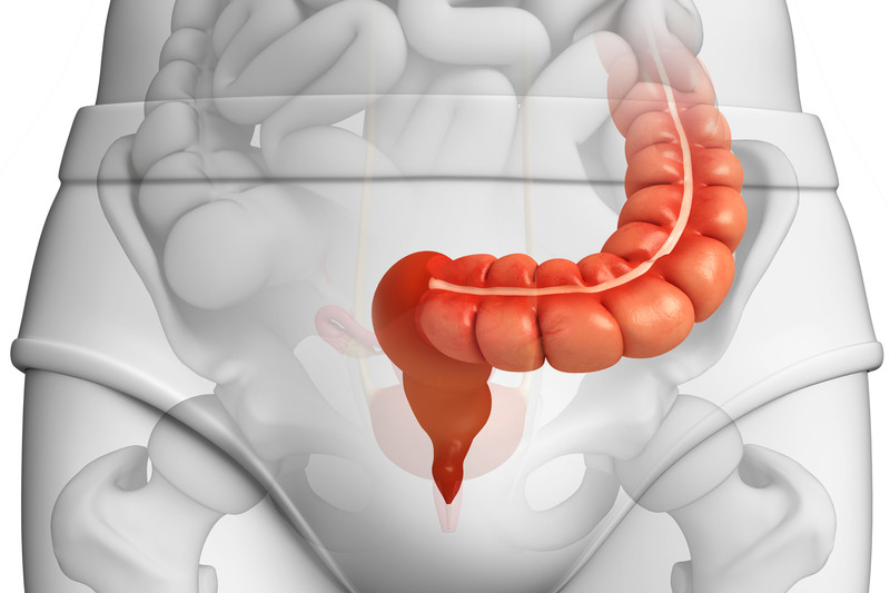 rastreamento do câncer do intestino grosso