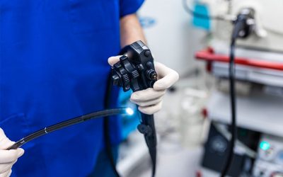 Colonoscopia aos 45 anos: por que essa recomendação ficou ainda mais importante