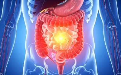 Diagnóstico de câncer digestivo: o que fazer agora?